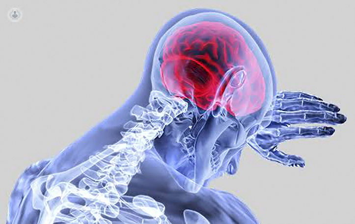 Bukan Cuma Diderita Lansia, Stroke Juga Bisa Terjadi di Usia Muda Karena Hal Ini