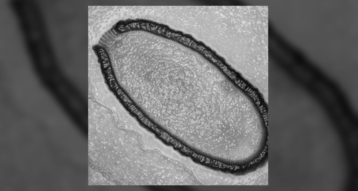 Beberapa Jenis Virus yang Ditemukan Ilmuwan di Permafrost