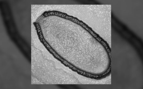 Beberapa Jenis Virus yang Ditemukan Ilmuwan di Permafrost