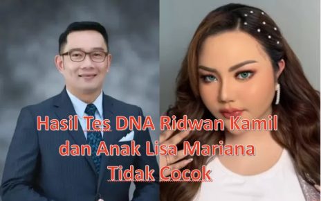 Hasil Tes DNA Ridwan Kamil dan Anak Lisa Mariana Tidak Cocok