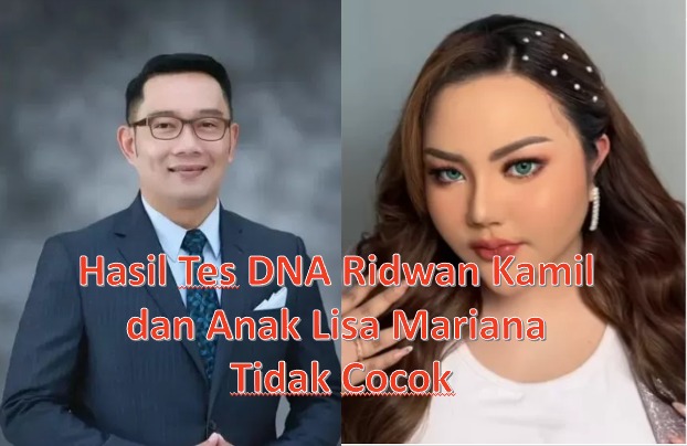 Hasil Tes DNA Ridwan Kamil dan Anak Lisa Mariana Tidak Cocok